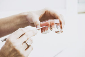 Implant11