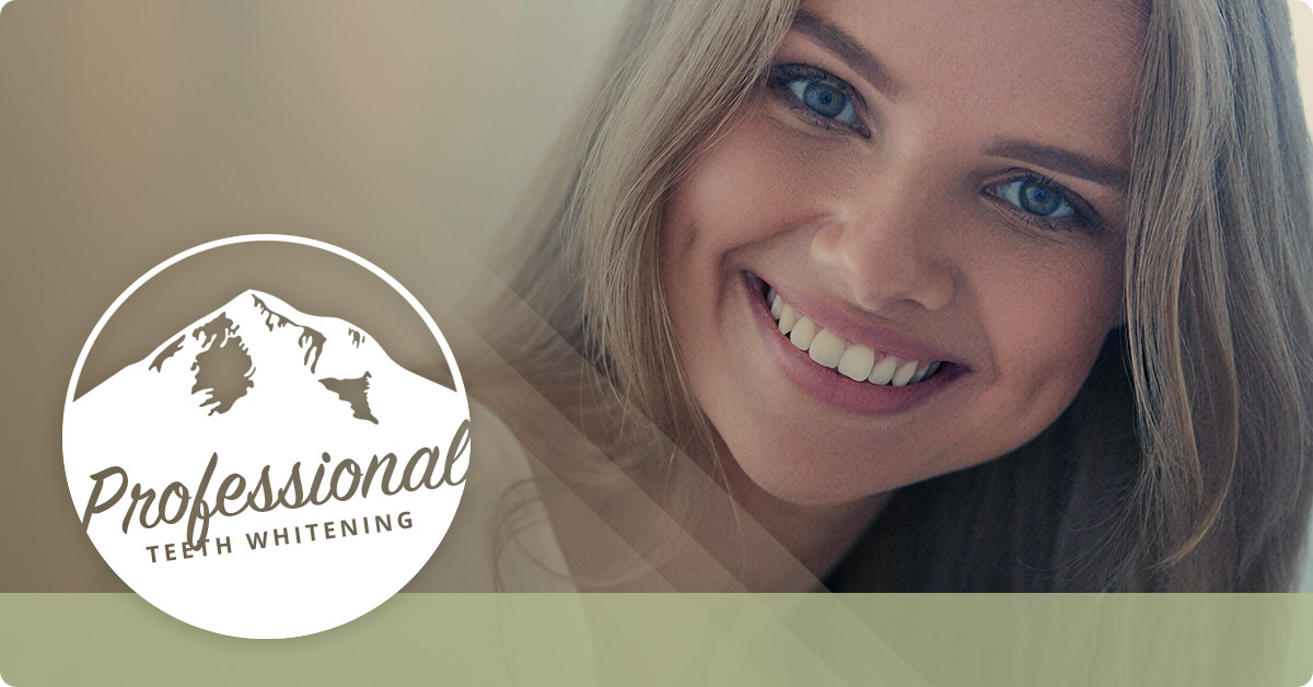 Professional-Teeth-Whitening-5c2cf845b941b