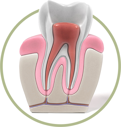 root-canel-5dd40ffadd5e9