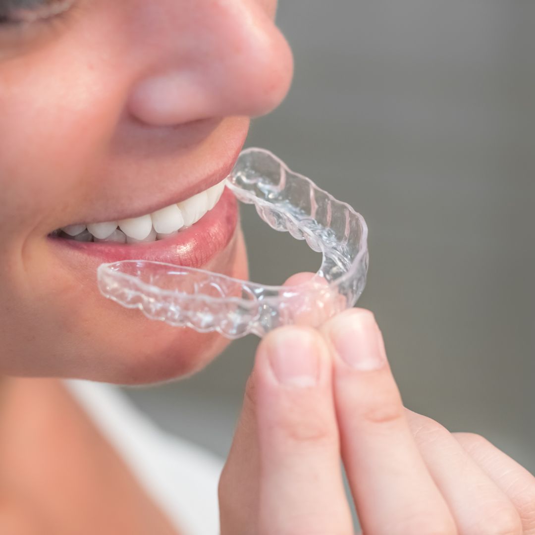 oral appliance