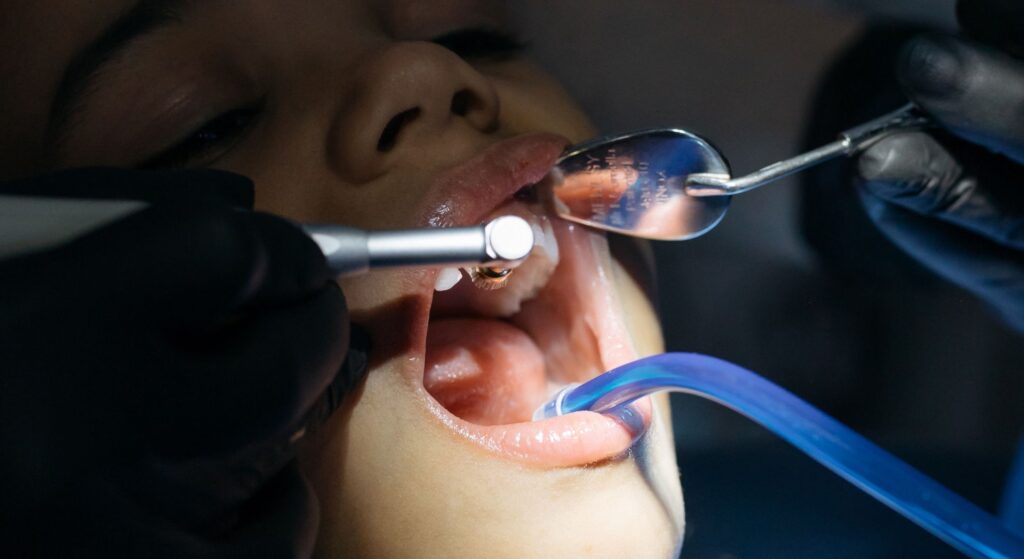 open mouth with dental tools in it