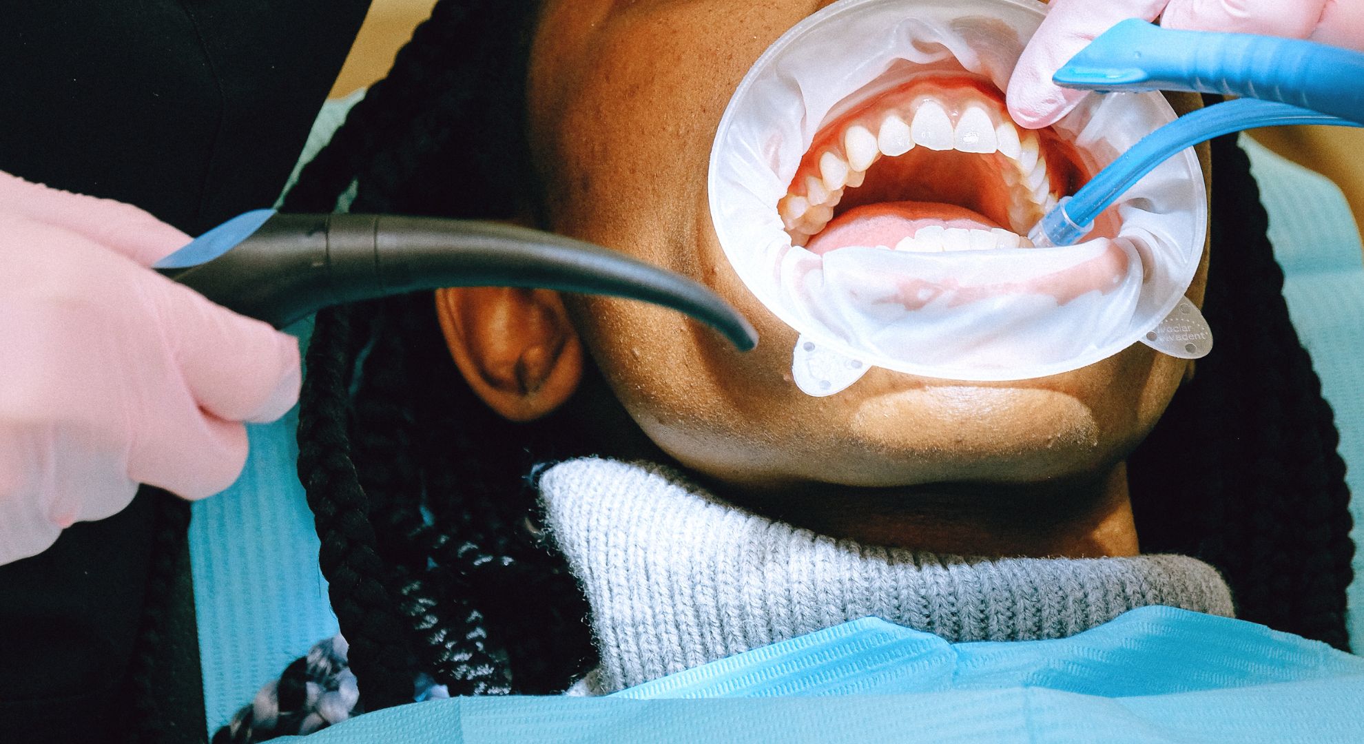 Top 4 Benefits of Professional Teeth Cleaning Hero