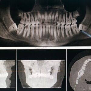 dental xray
