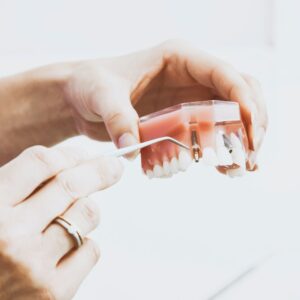 Dental implant model