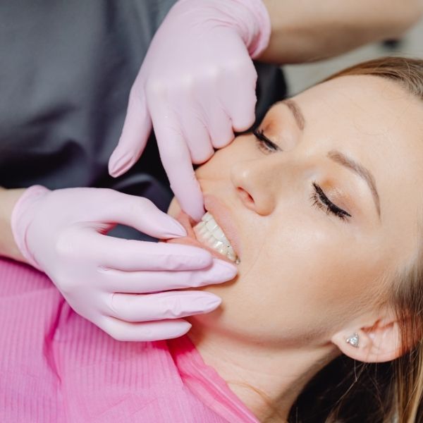 applying whitening to teeth